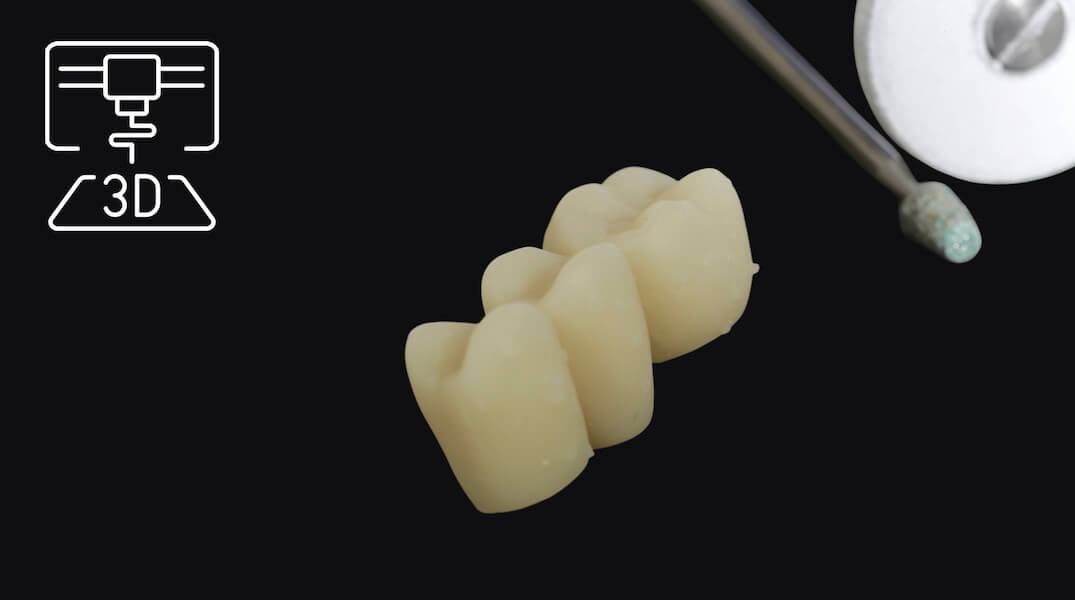 Dentaler 3D-Druck