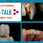 Team-Talk Micro-Layering