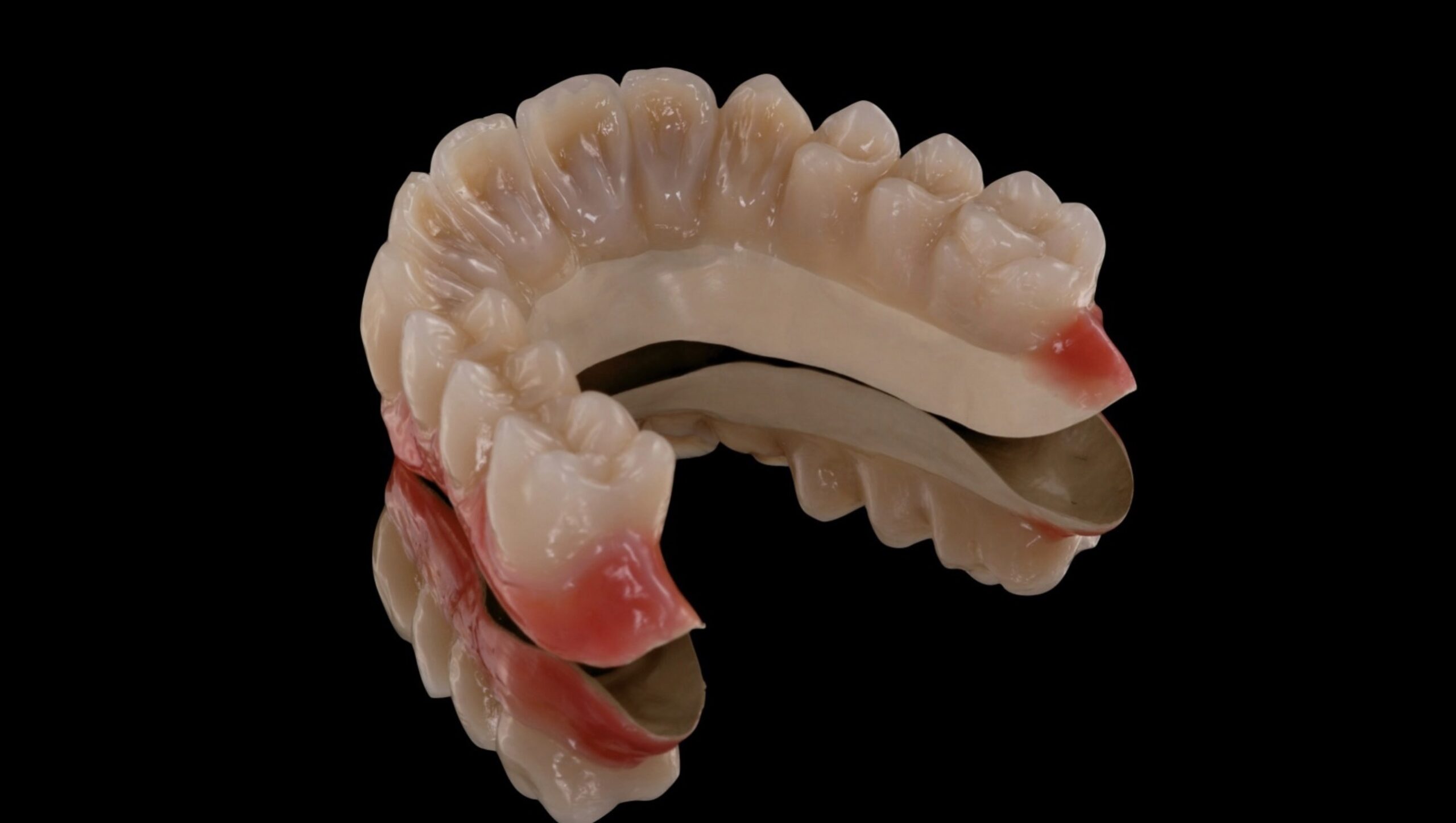 PAEK Kunststoffe: Der Schritt zur monolithischen Versorgung?